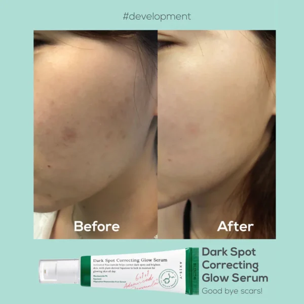 dark spot correcting glow serum - Image 2
